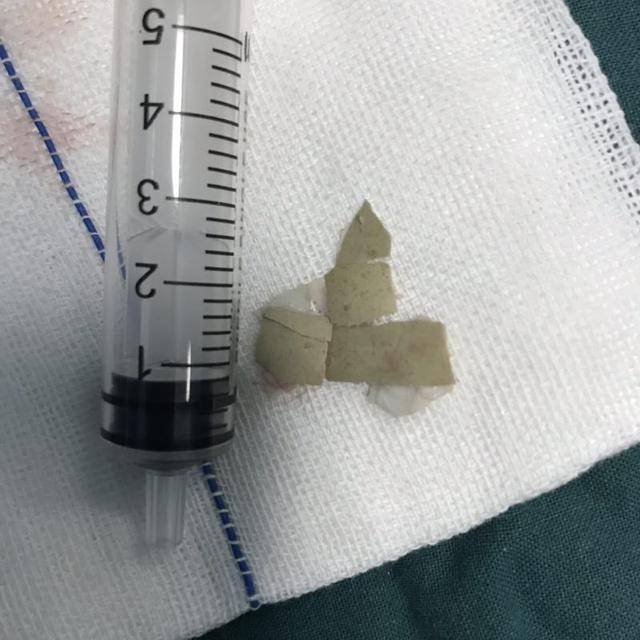 沈阳四院治耳鼻喉好吗,沈阳四院治耳鼻喉吗