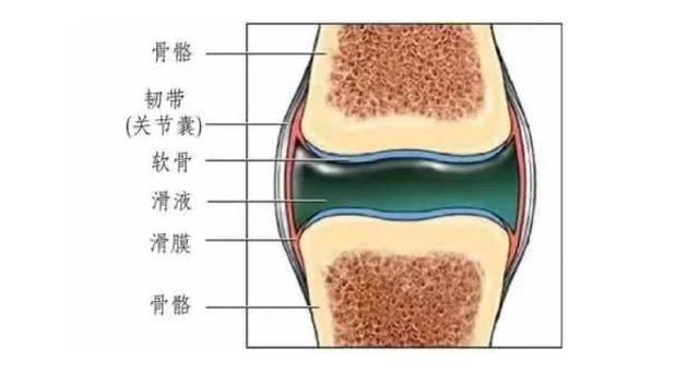 60-70岁膝盖滑膜炎最佳治疗方法,10个膝盖痛9个滑膜炎