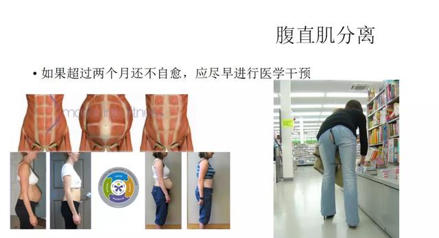 产后恢复少女感,有关产后恢复的图片