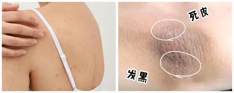 秋冬换个电动澡刷，深入清洁美肤，按摩从头爽到脚