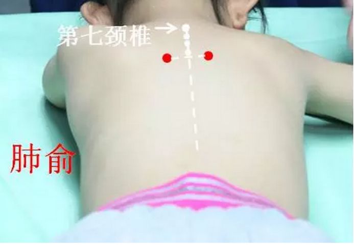 宝宝咳嗽推拿手法图解视频教程,四个月的宝宝咳嗽流鼻涕推拿手法
