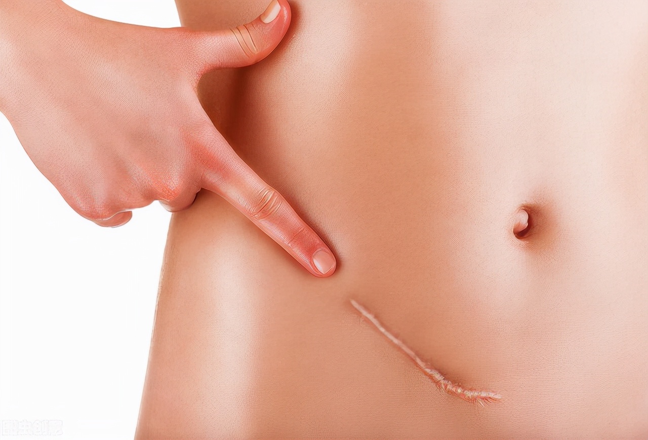 孕妇阑尾炎要保住胎儿要怎么办,孕妇得阑尾炎能动手术吗