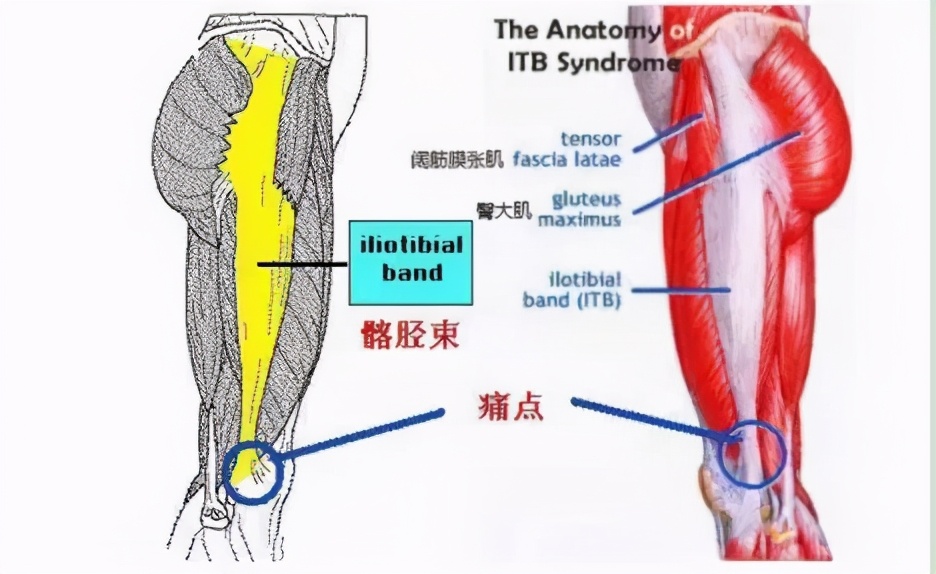 跑步对膝盖的正确训练,错误跑步姿势小腿疼怎么办
