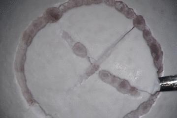 医学缝针练习,医生如何练习缝针