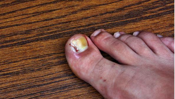 娌夋蹈寮忔不鐤楃敳娌熺値,閮戣繙鍏冩不鐤楃敳娌熺値