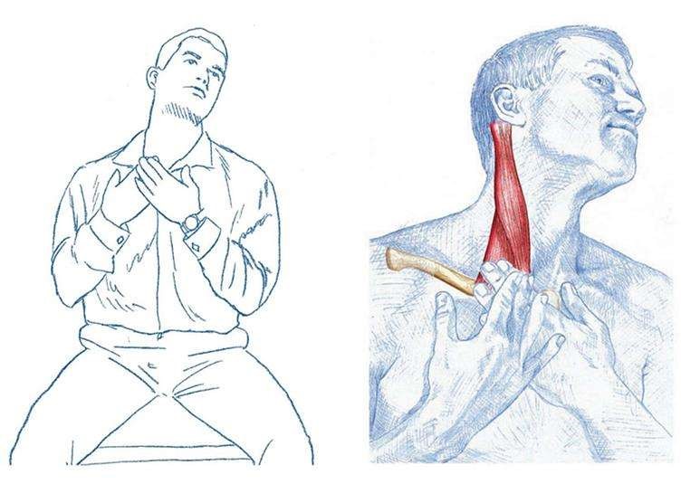 胸锁乳突肌疼痛及原因,胸锁乳突肌疼痛怎么康复解决