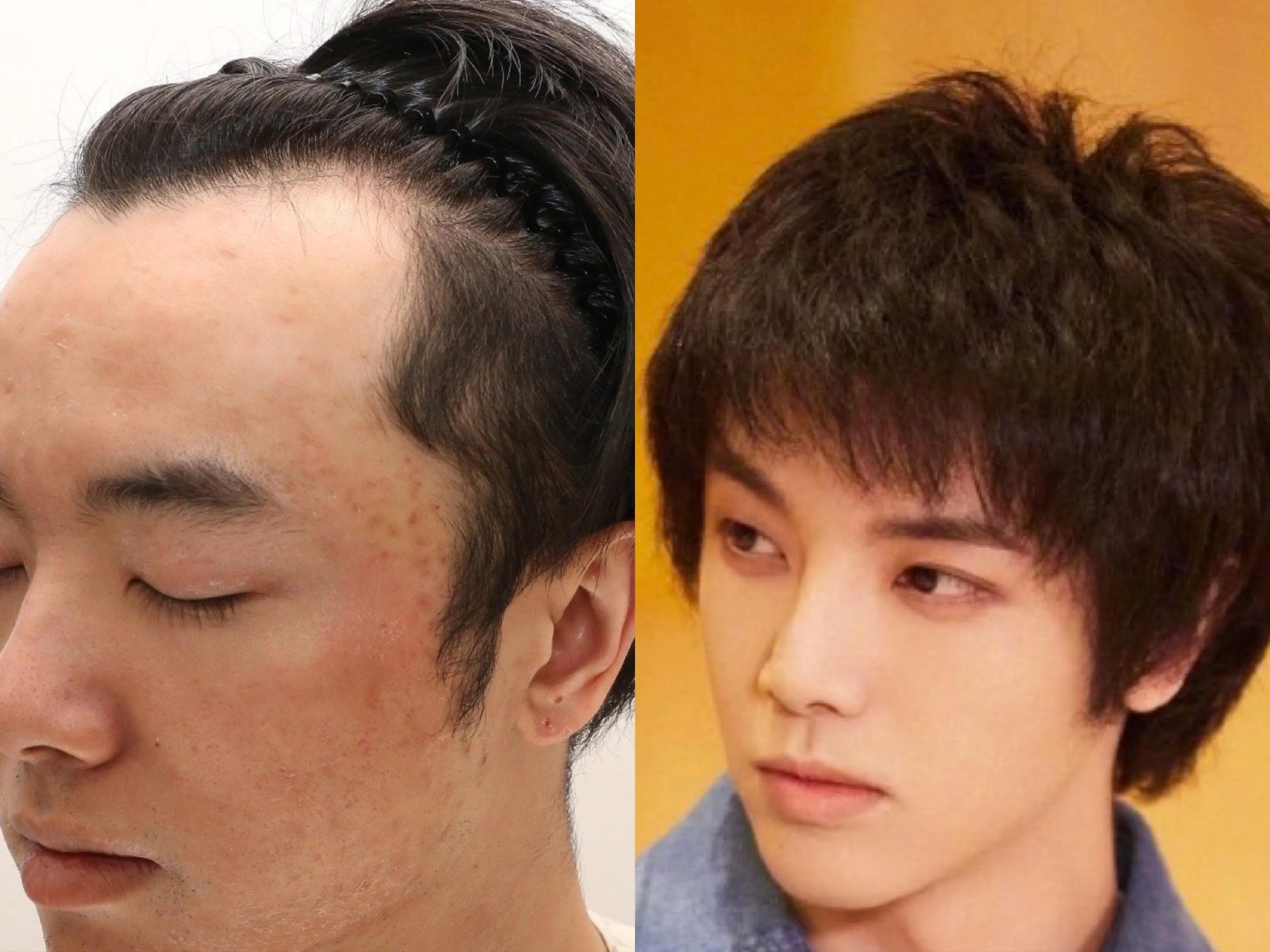 整容秃头还出轨？“发发爱我2021”拿着视频来锤华晨宇了