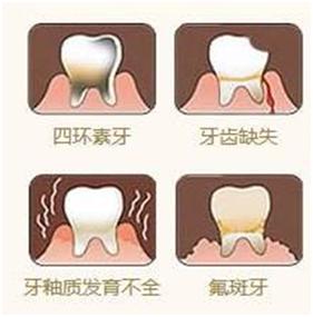 牙齿为什么会出现两种颜色,牙齿变色变成黑色是什么原因