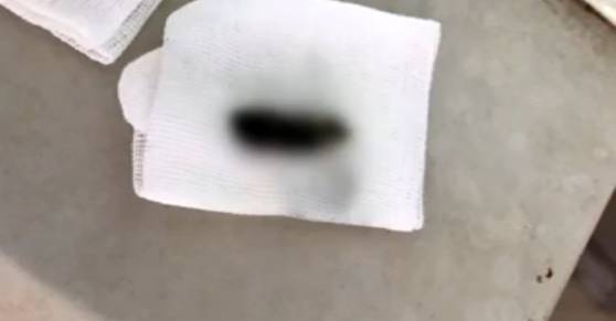 用棉签掏耳朵的危害动画,用棉签掏耳朵对身体有害吗