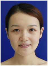 小姐姐体验面部针灸,小姐姐首次尝试面部理疗视频