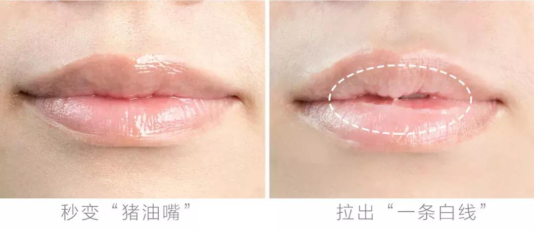 唇炎唇干起皮用什么唇膏,干唇救星唇膏