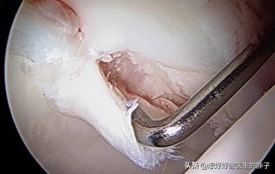 髋关节疼痛两腿不一样长如何康复,左大腿髋关节突然疼痛是什么原因