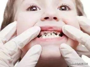 薇娅卖电动儿童牙刷是哪期,紫外线u型牙刷儿童