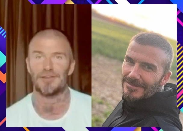 贝克汉姆严重脱发,贝克汉姆脱发原视频