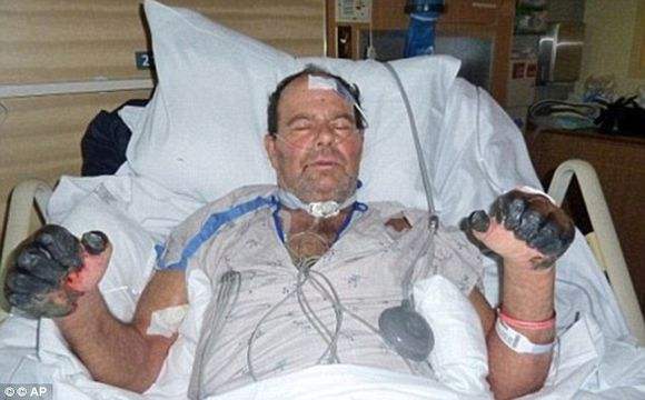 一文看懂传染病的传播,鼠疫防治科普知识问答