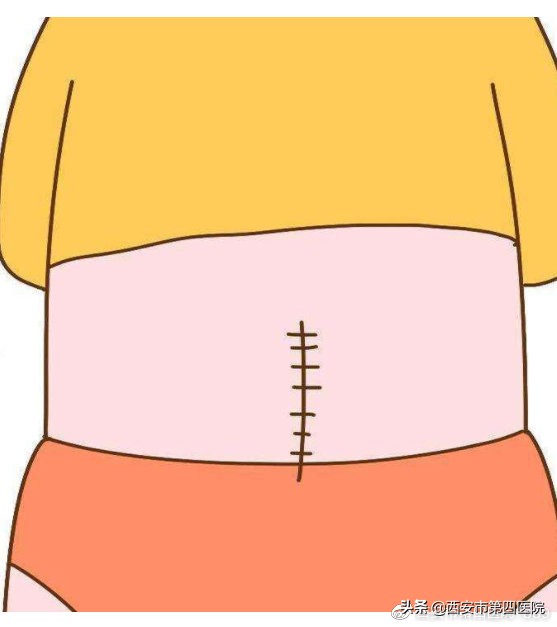 什么情况下选择剖腹产,什么情况可以选择剖腹产