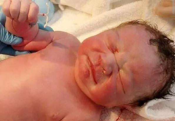 小铜环对中国女性的危害,母亲肚子里的环有什么伤害