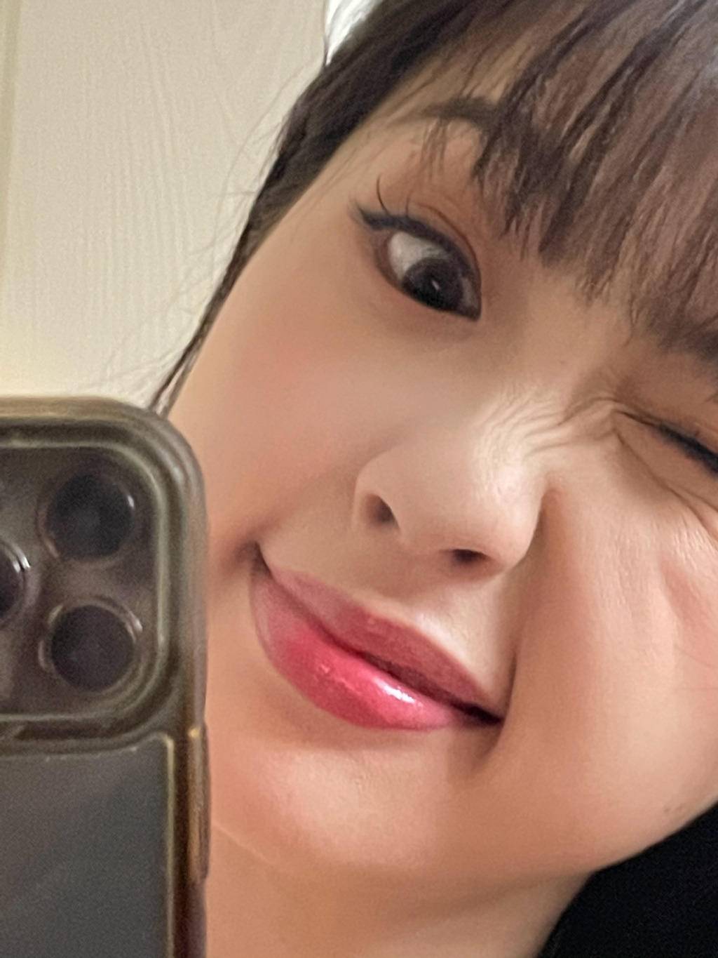 严重泪沟黑眼圈,淡化黑眼圈和泪沟原理