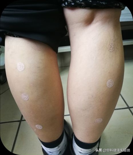 老年人腿抽筋的原因和处理方法,老年人大腿抽筋的原因和处理方法