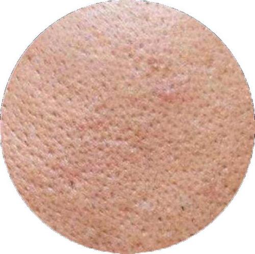 毛孔粗大如何改善不用护肤品,毛孔粗大怎么办不花钱