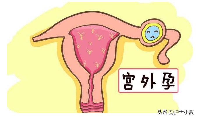 宫外孕会导致非经期出血吗,非经期出血宫外孕