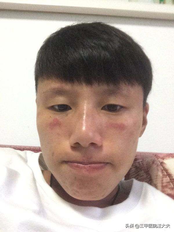 喝酒脸白的人比脸红的人更危险吗,喝酒脸红的危险