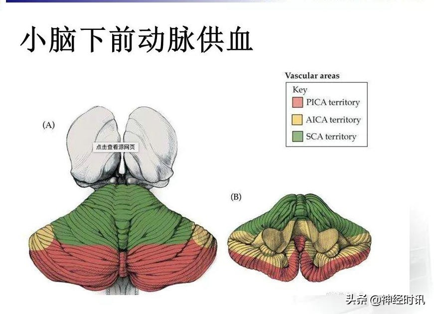 脑动脉解剖学讲解,基底节区脑血管解剖