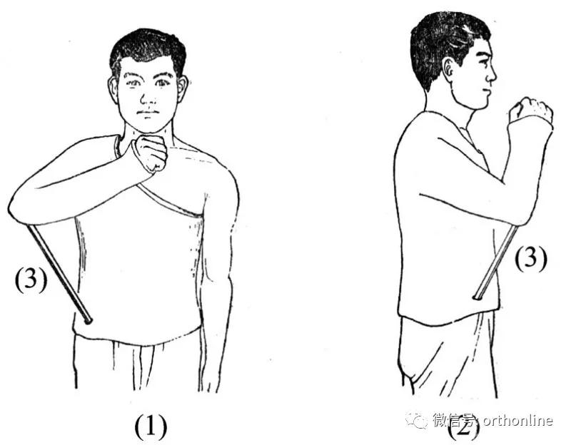 石膏固定术的科普视频,石膏固定术的正确方法
