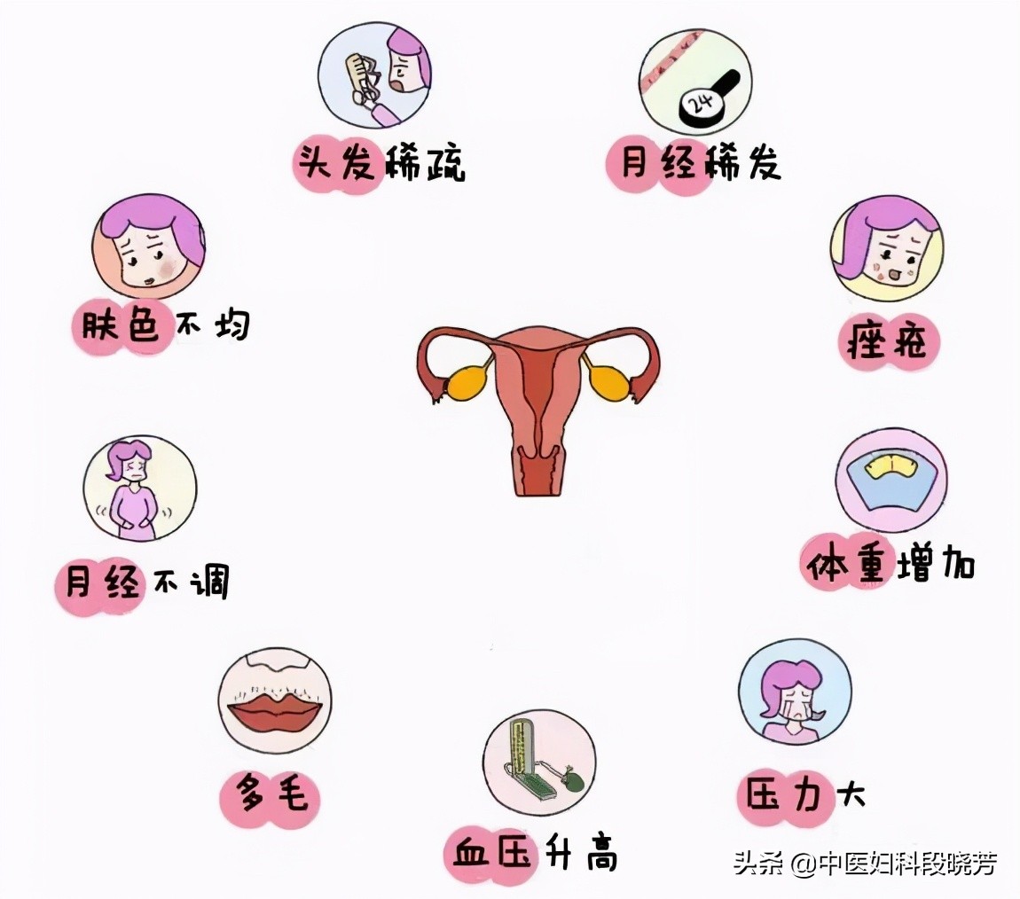 月经不正常长痘脱发是卵巢多囊吗,多囊卵巢综合症脱发头皮长痘