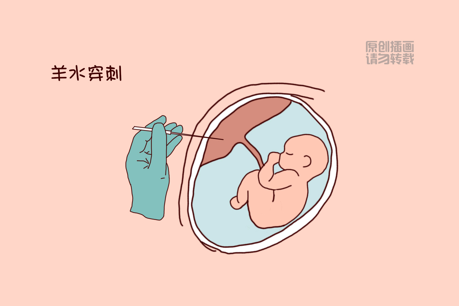 孕期唐氏筛查做了还要做无创吗,孕期唐氏筛查一定要做吗