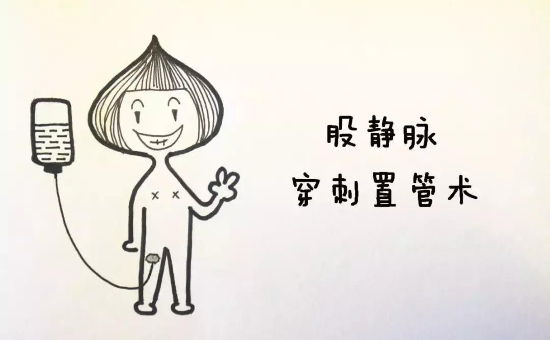 股静脉穿刺置管输液,股静脉穿刺置管术详细讲解