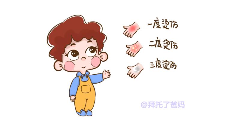 宝宝烫伤谨记五步急救法,宝宝烫伤后正确的处理方法是什么