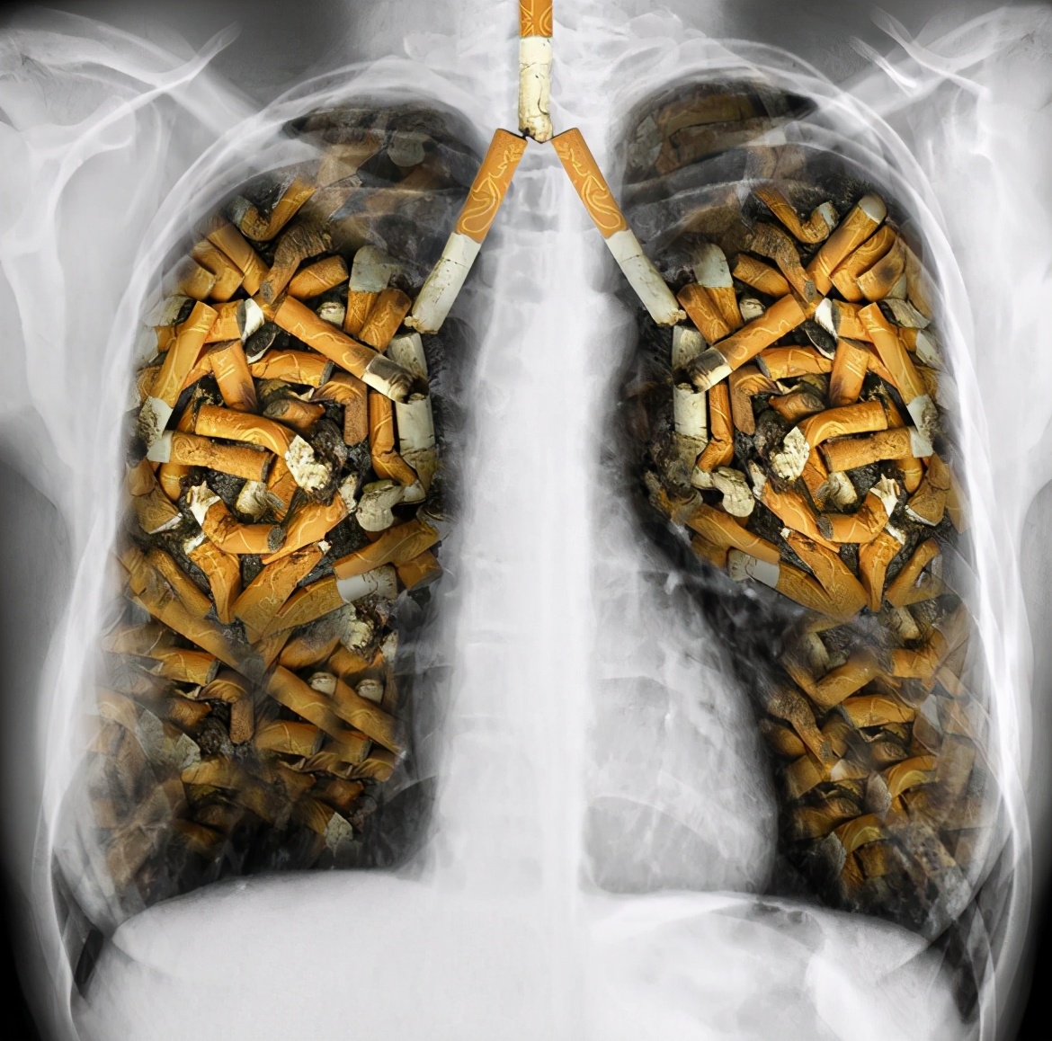 吸烟30年的肺戒烟后的变化,戒烟以后多久肺会恢复变白