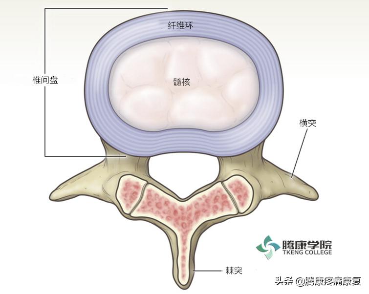 腰椎间盘退行性改变怎么治疗呢,腰椎退行性变和腰间盘突出哪个重