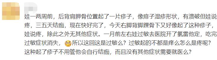 头上干性湿疹怎么护理,被湿疹折磨的宝宝