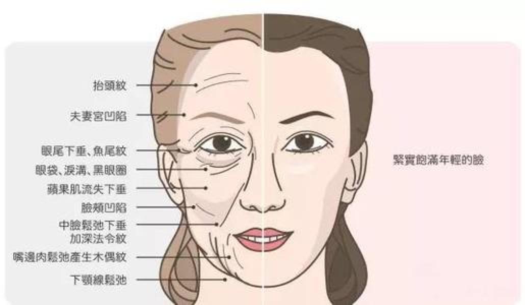 淡化法令纹最有效的方法,淡化法令纹真实有效的方法