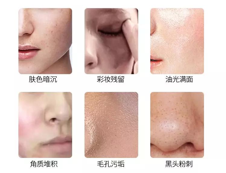 iry净透水面膜,iry面膜真的有效吗