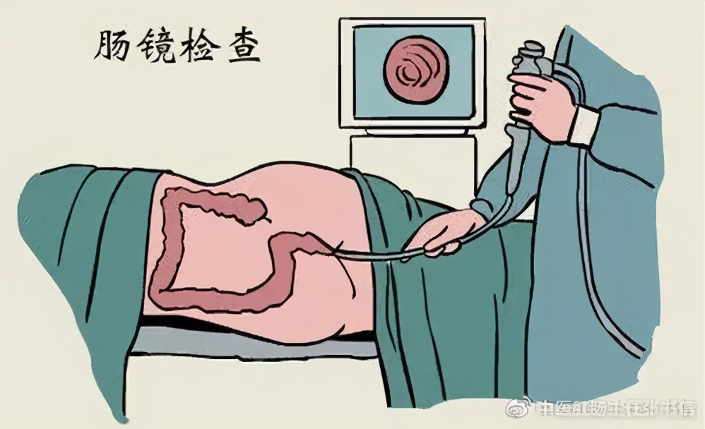 大便带血小腹痛挂什么科室,大便带血下腹疼痛