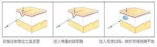 抗皱纹抗老小妙招,30岁后的面部抗老思路