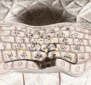 美白针是违法的吗,美白针出事的几率