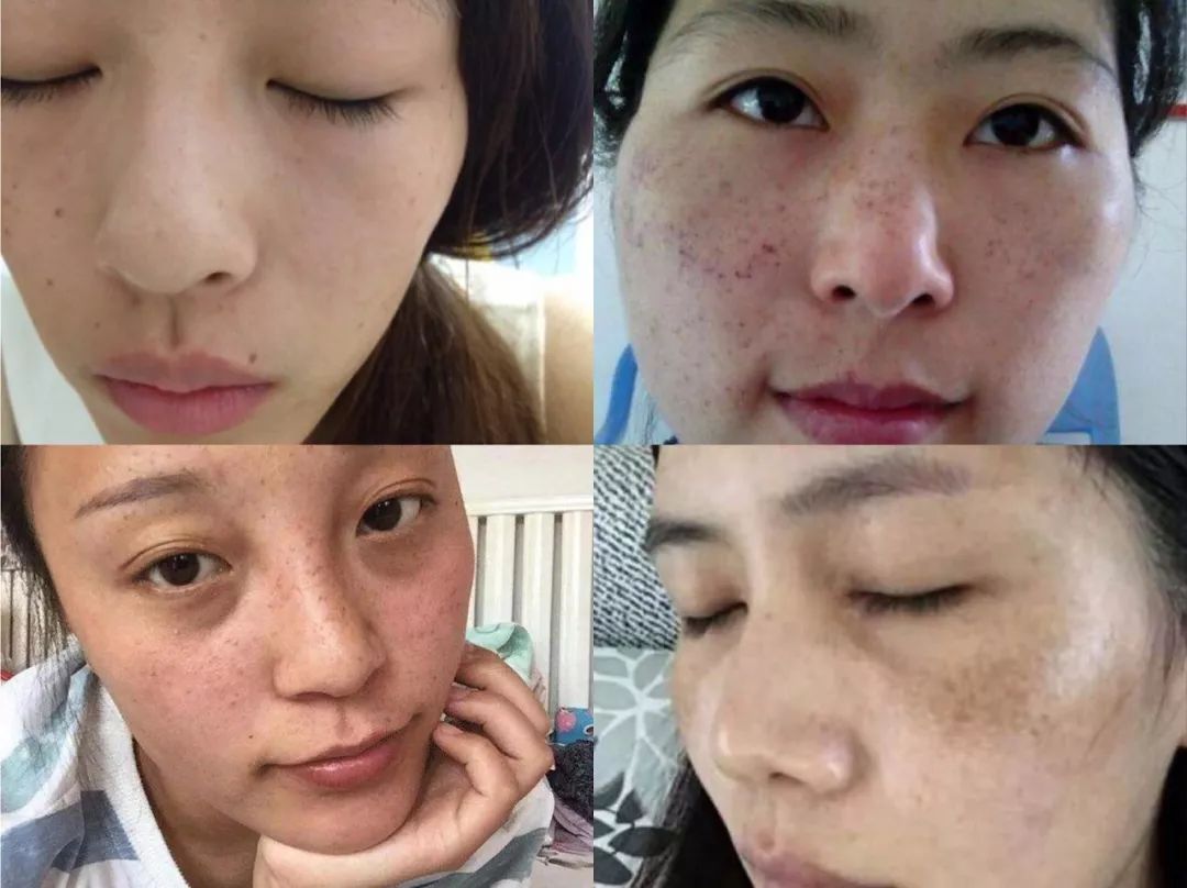 石头姐艾玛斯通拍摄,石头姐艾玛斯通新作品