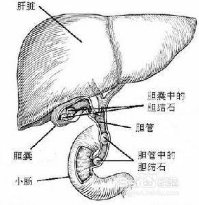 肝胆湿热引起胆红素升高吃什么药,长期吃药引起总胆红素偏高怎么办
