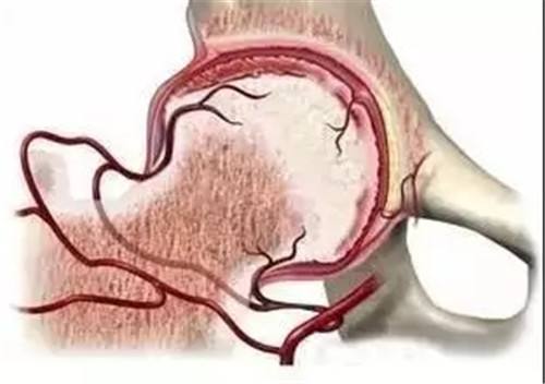 29岁右股骨颈骨折恢复最佳的方法,82老人股骨头摔骨折了该怎样治疗