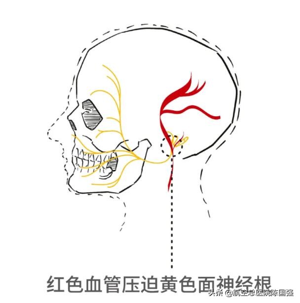左眼跳财右眼跳灾怎么来的,左眼跳财右眼跳灾用科学知识解答