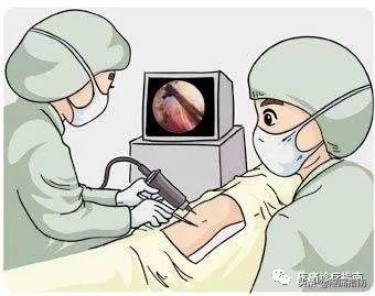 骨性关节炎诊疗指南2019解读,骨性关节炎的护理诊断和措施