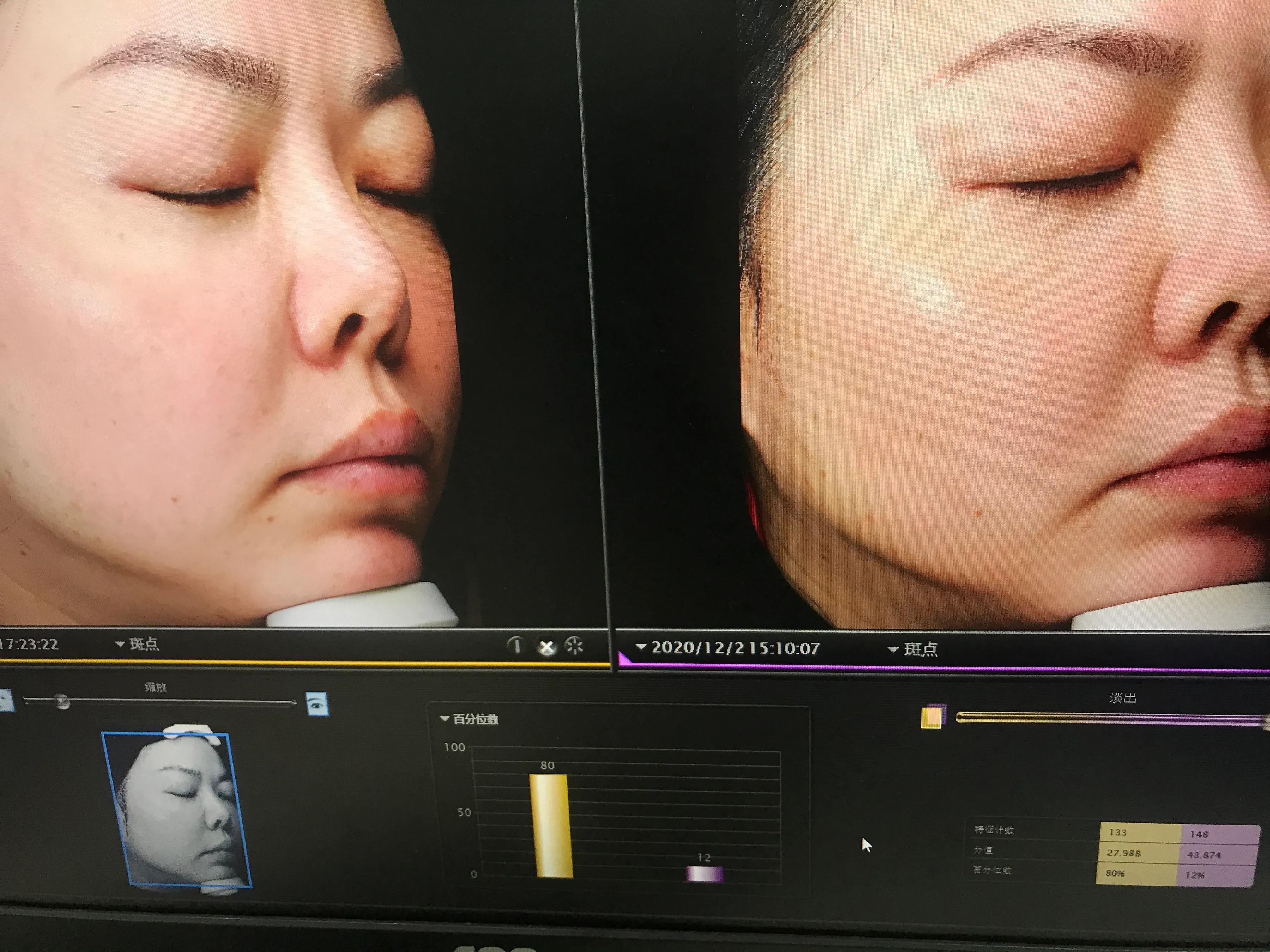 玉兰油超红瓶和sk2大红瓶,玉兰油淡斑小白瓶和sk2哪个好