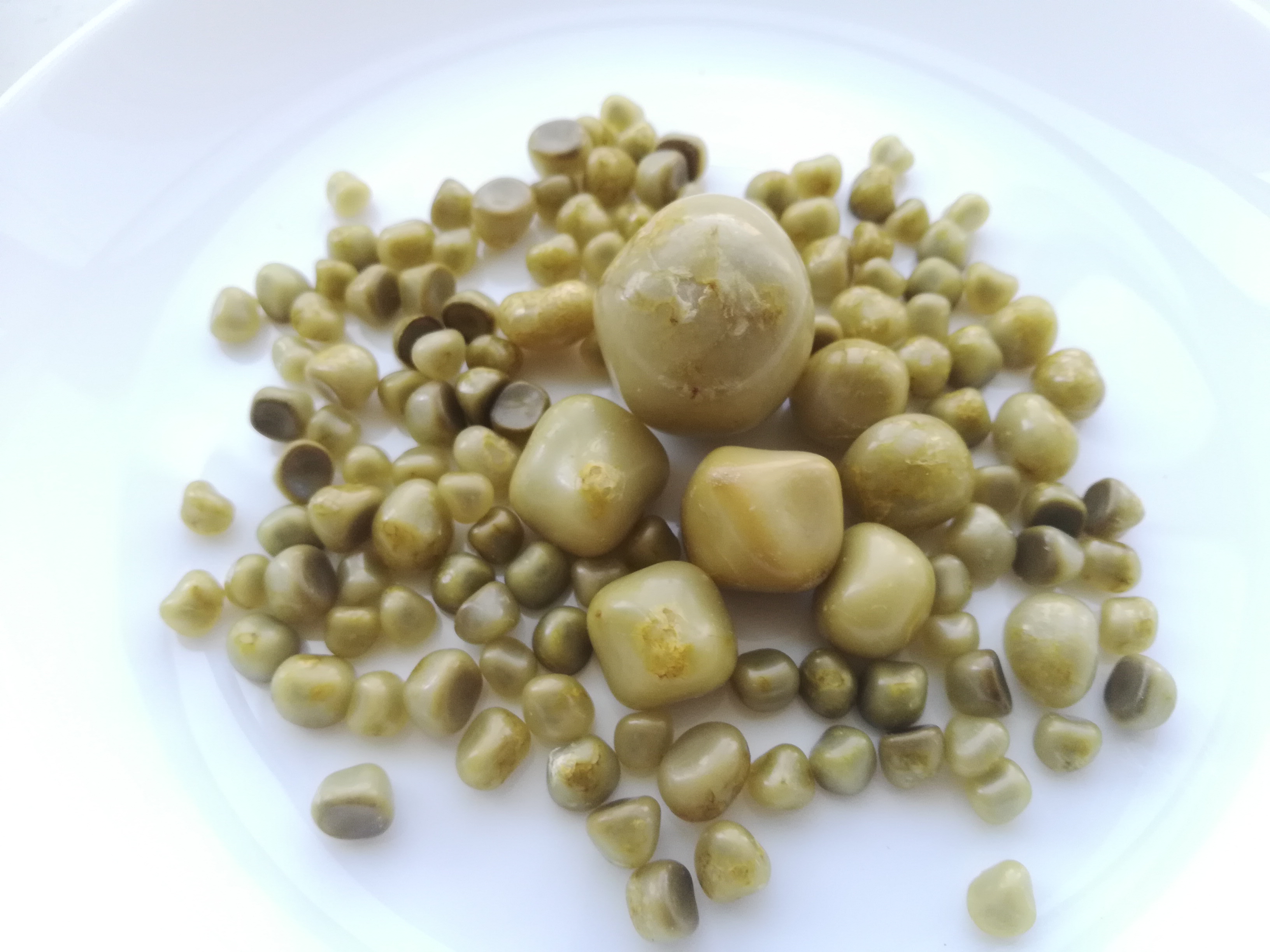 冬天结石发病高,胆结石为什么容易冬天发作