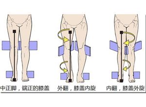 宝宝膝外翻内八最佳矫正年龄,儿童膝外翻需要矫正吗