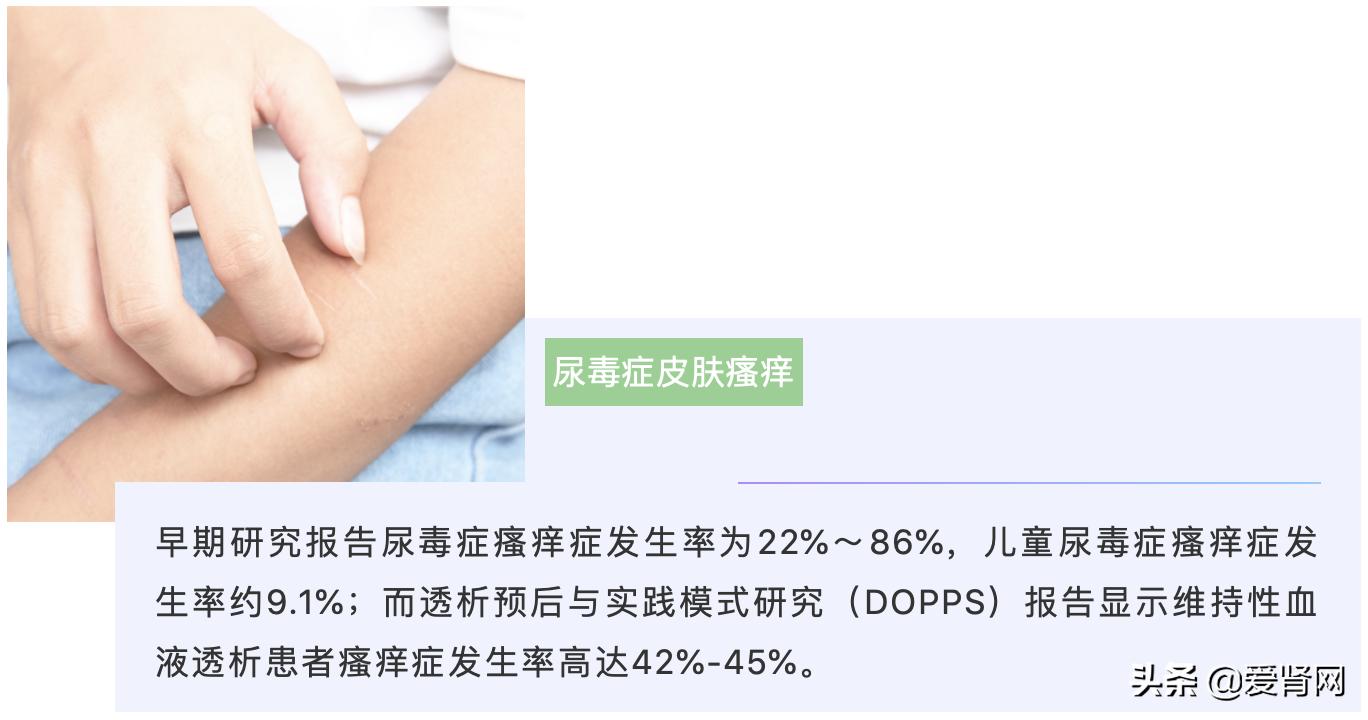 肾友缓解皮肤瘙痒最全方案，真的不要错过本文