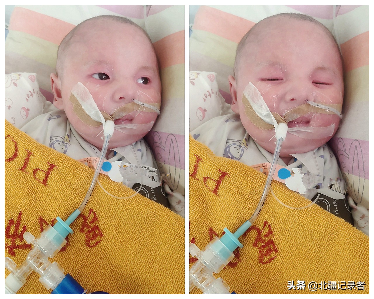 刚出生婴儿从鬼门关救回,宝宝一出生就被抢救